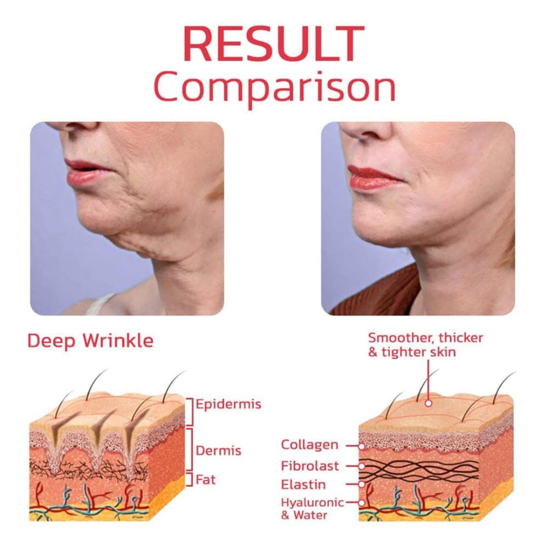 Nmn Aging Face Serum 140ml