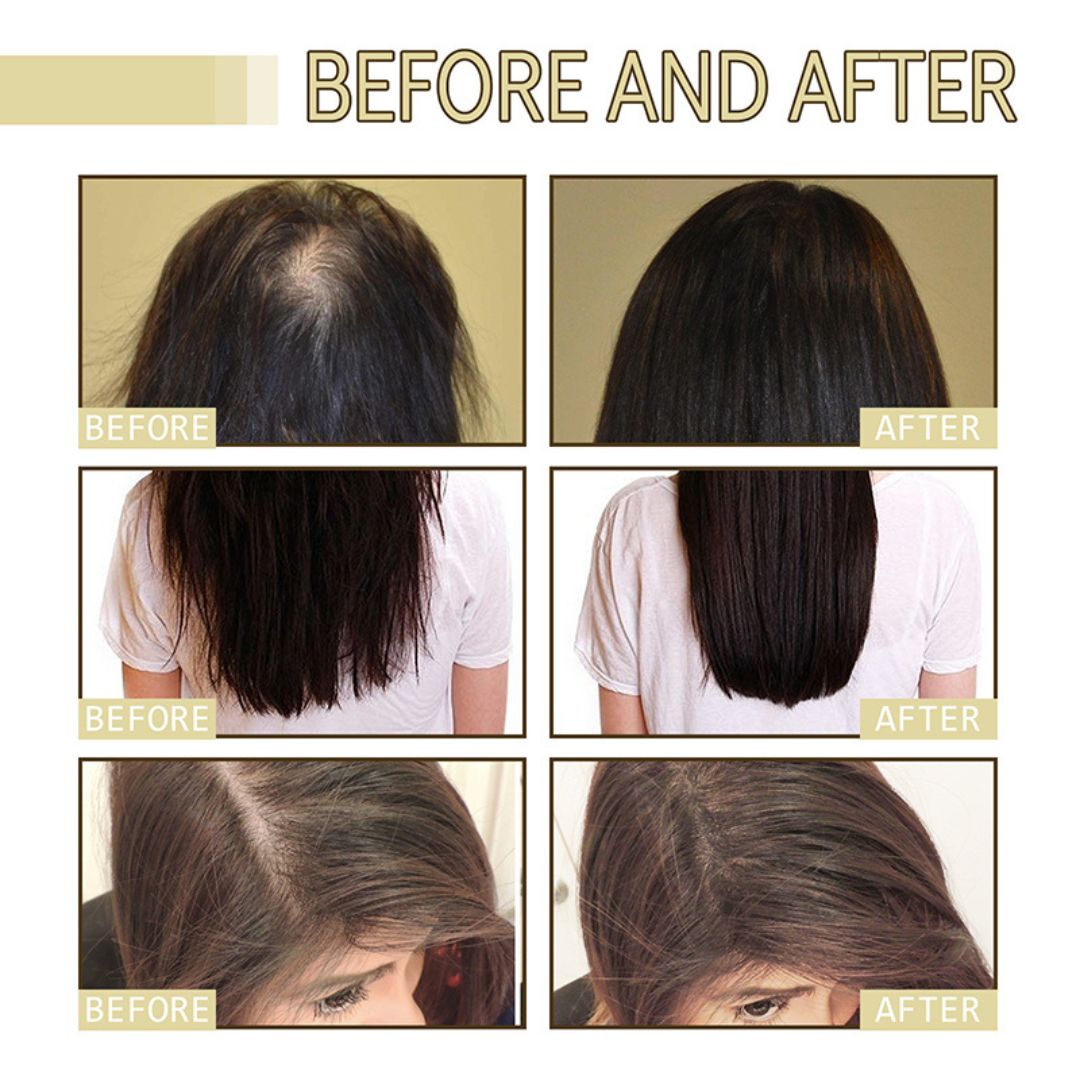 Natural Hair Growth Oil (BUY 1 GET 1 FREE)